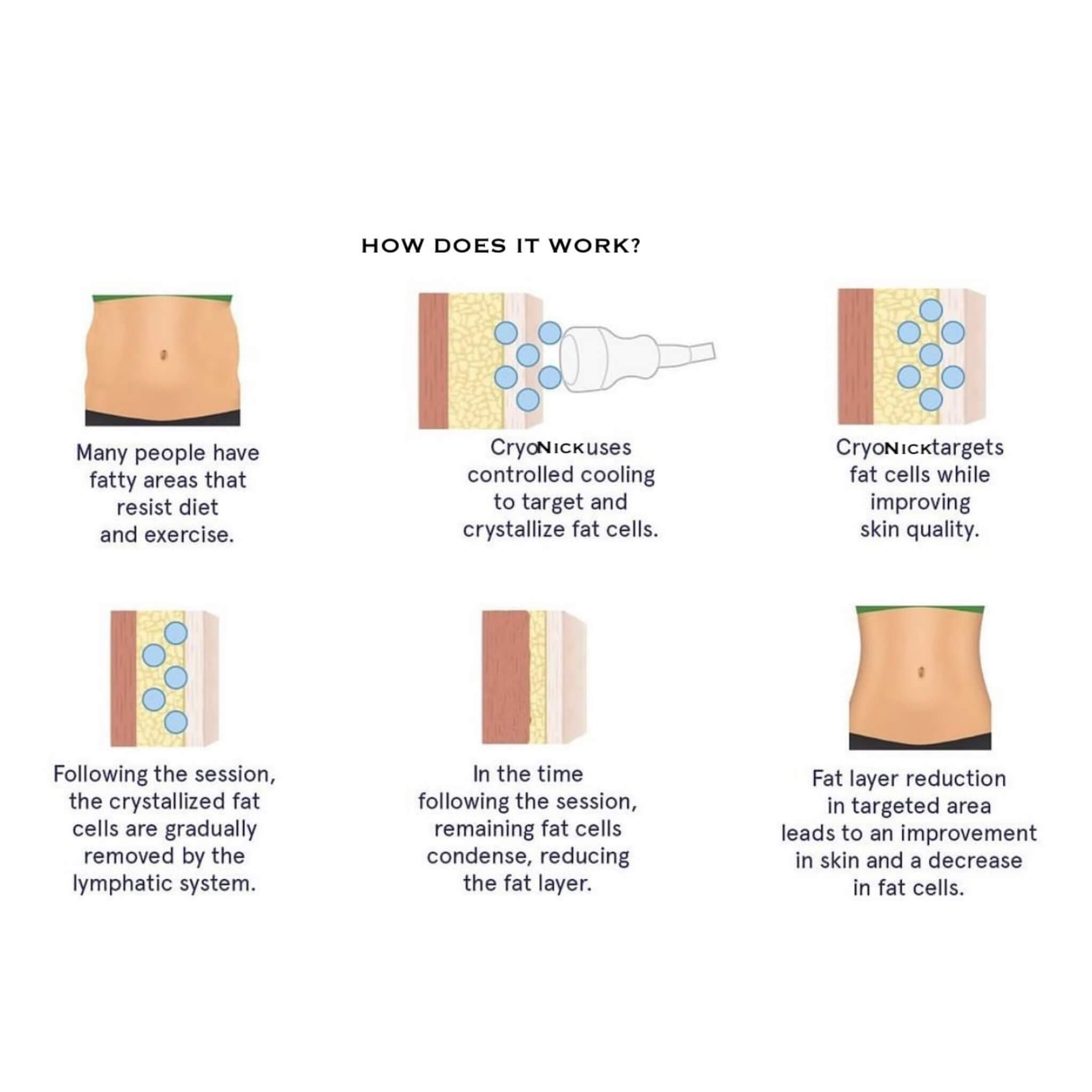 Cryonick Wellness Technology Factory Iceberg Cryonick Roller Mini – Portable Cryo Massage Unit