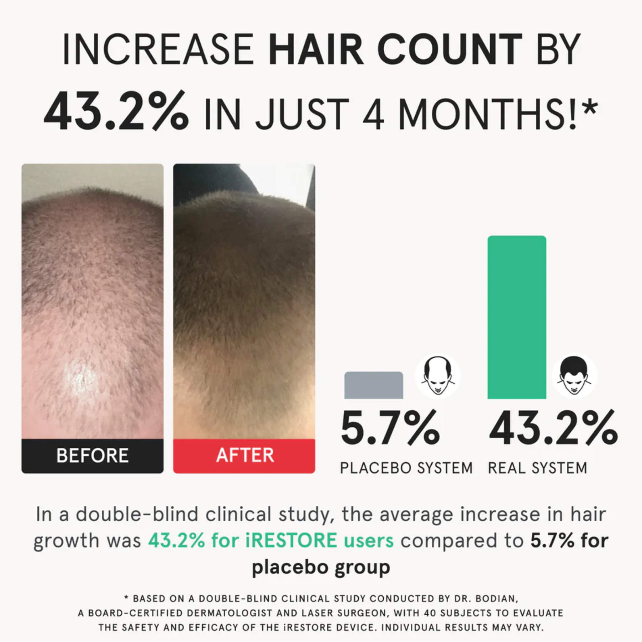 iRESTORE clinical study showing 43.2% increase in hair count versus 5.7% for placebo group