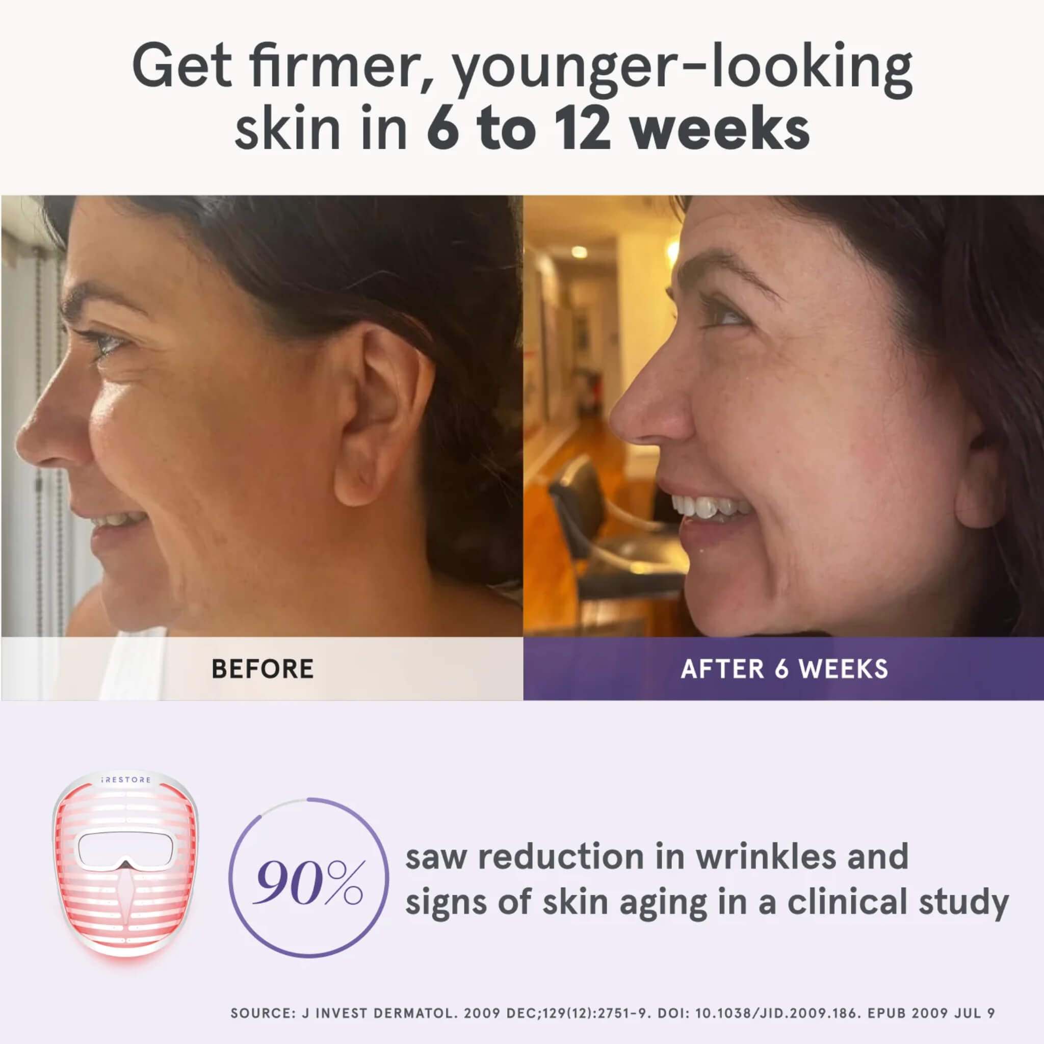 Before and after photos showing firmer, younger-looking skin after 6 weeks of iRESTORE Illumina use