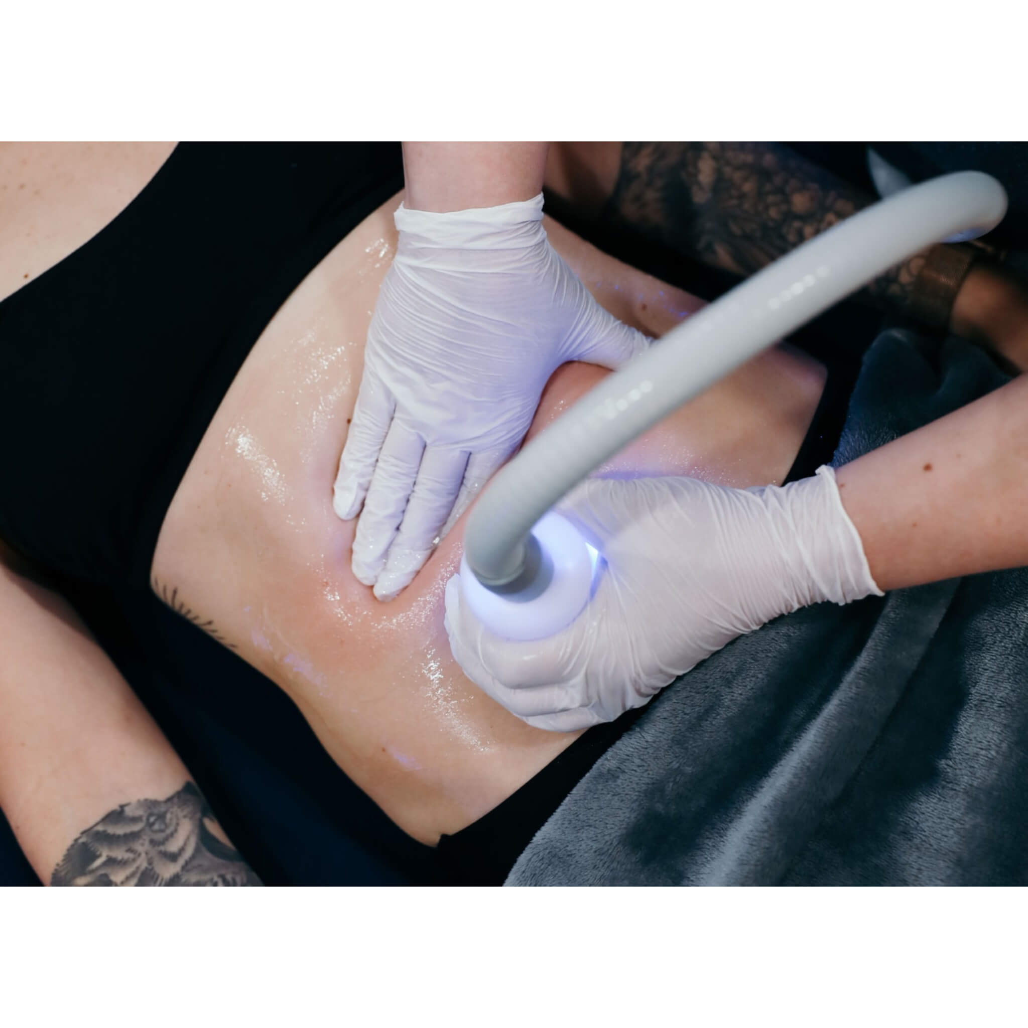 Vacuactivus Iceberg Cryonick Roller Mini – Portable Cryo Body Sculpting & Lymphatic Massage Machine