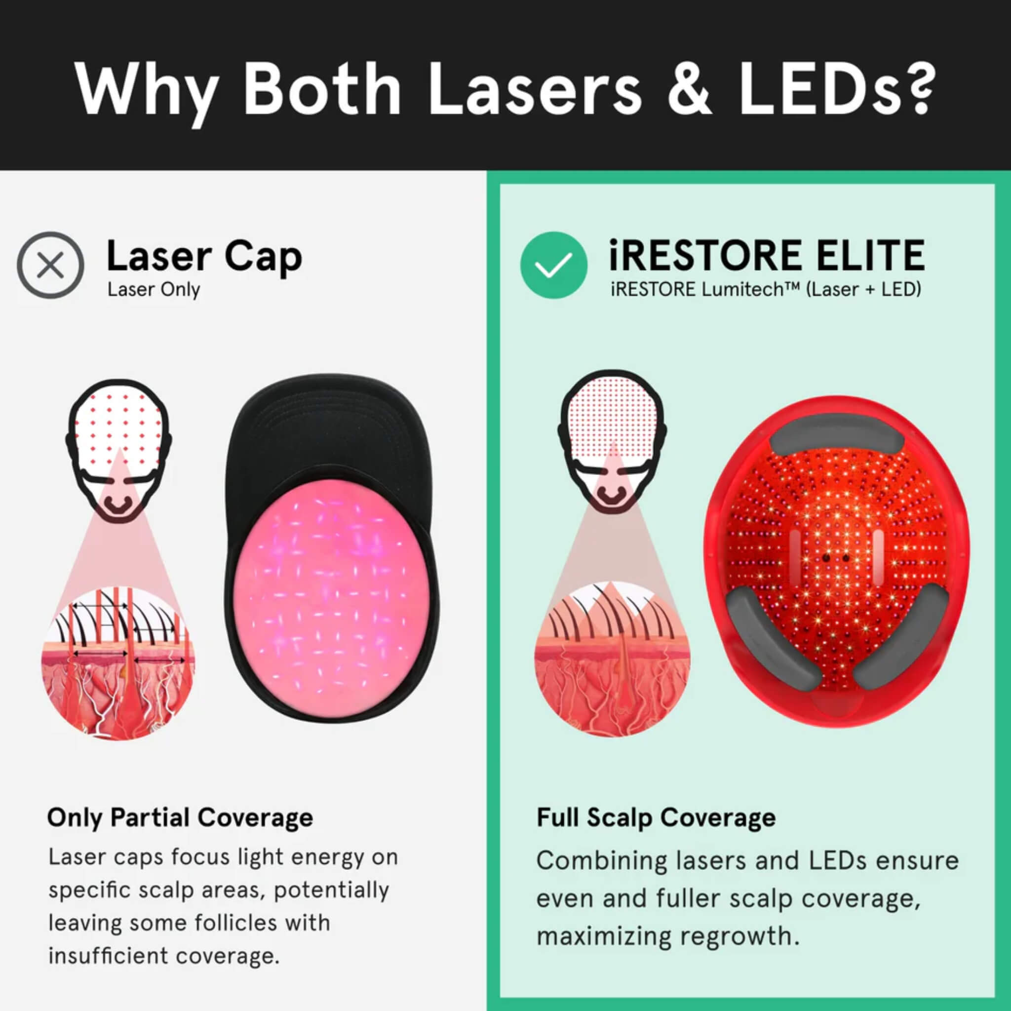 iRESTORE Elite Lumitech technology combining lasers and LEDs for full scalp coverage versus laser cap partial coverage comparison