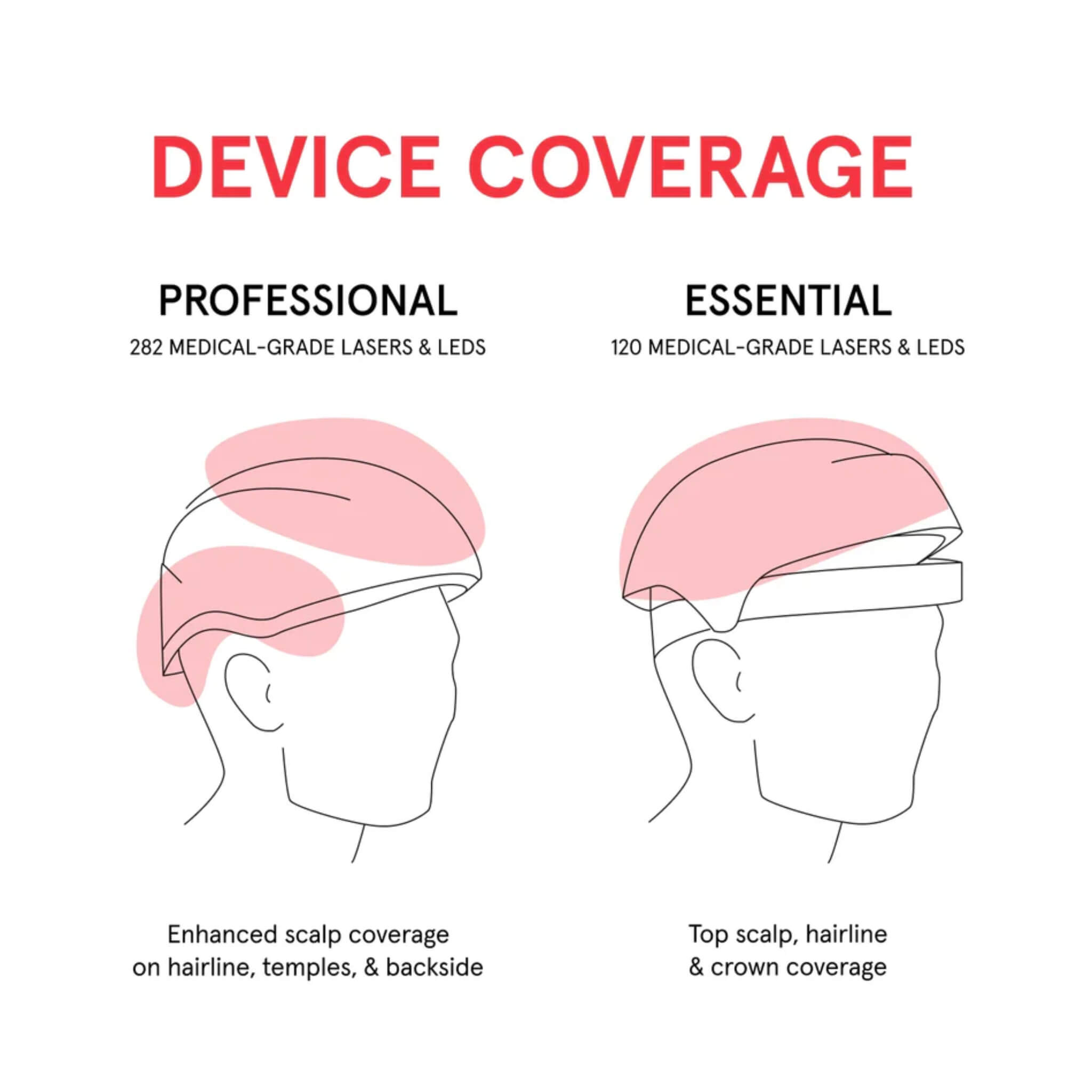 iRESTORE Essential versus Professional scalp coverage comparison diagram