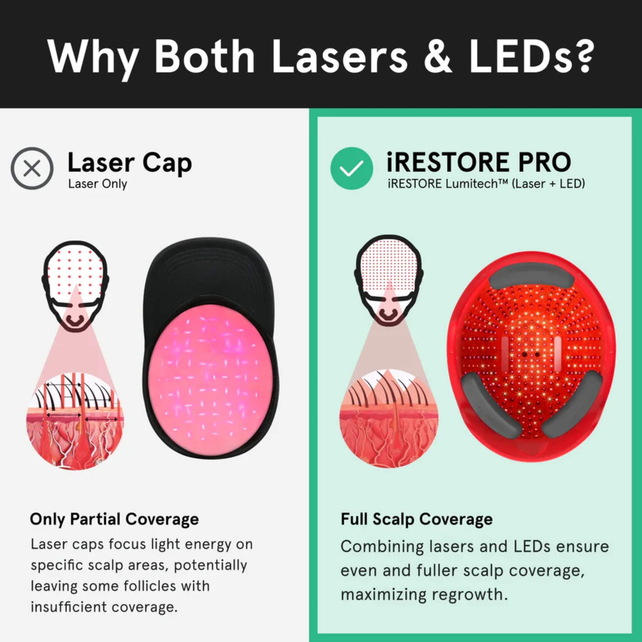 Why iRESTORE Professional combines lasers and LEDs for full scalp coverage versus laser-only caps